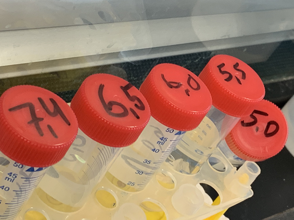 RWB Essen - Ein Tag im Labor des Uniklinikums Aachen - Vorbereitete pH-Lösungen